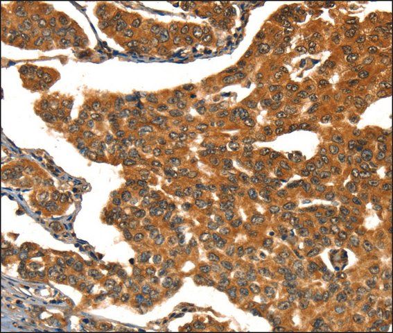 Anti-CACNA1E antibody produced in rabbit