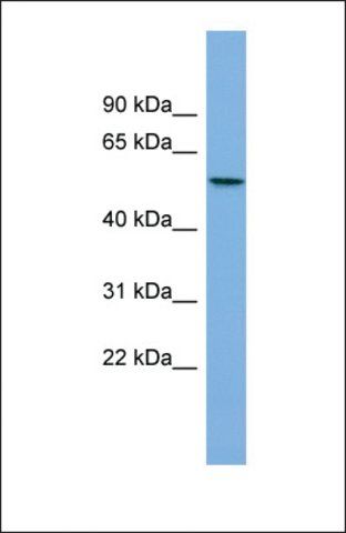 Anti-AGXT2L1 antibody produced in rabbit