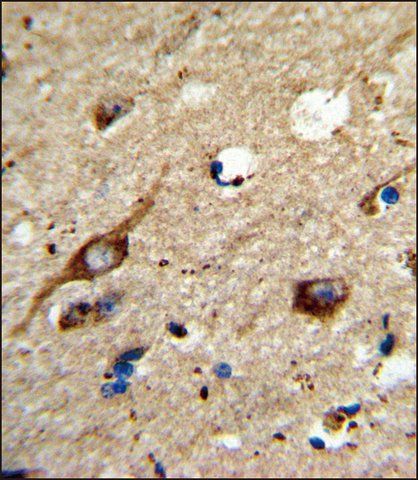ANTI-AGPAT3 (CENTER) antibody produced in rabbit