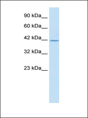 Anti-ALF antibody produced in rabbit