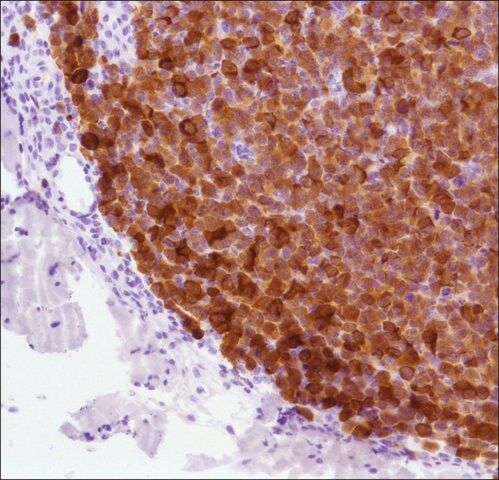 Anti-ALK/P80 antibody, Rabbit monoclonal