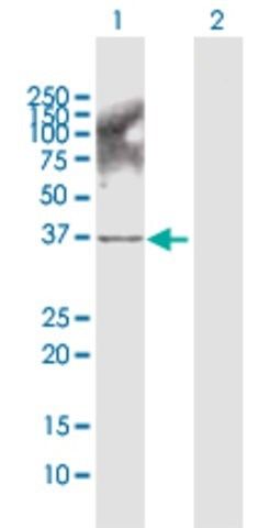 Anti-AKR1B10 antibody produced in rabbit
