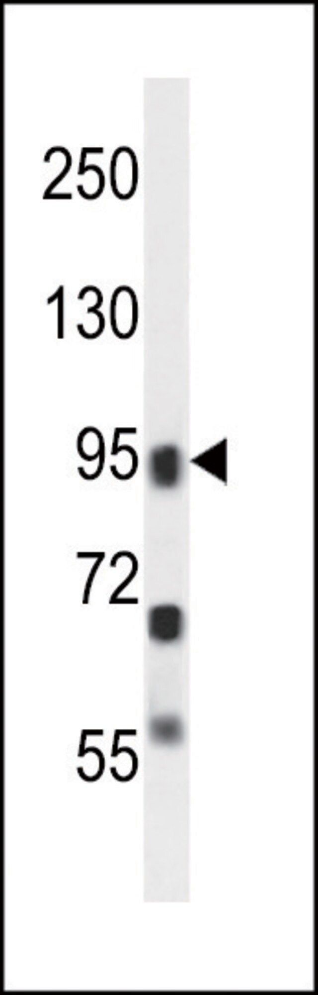 ANTI-ALOXE3 (CENTER) antibody produced in rabbit