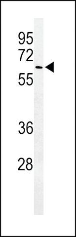 ANTI-ALG10(N-TERMINAL) antibody produced in rabbit