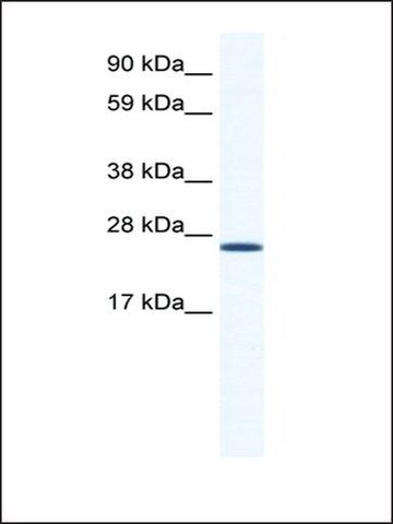 Anti-ARNTL (AB2) antibody produced in rabbit