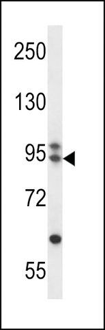 ANTI-ARMC9(N-TERMINAL) antibody produced in rabbit