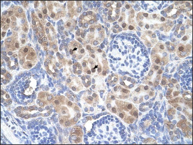 Anti-ARMCX6 antibody produced in rabbit