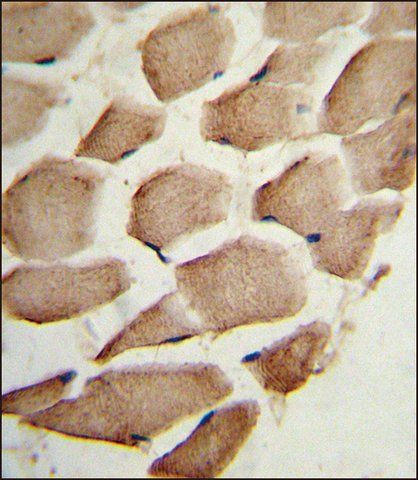 ANTI-ARPC1A (C-TERM) antibody produced in rabbit