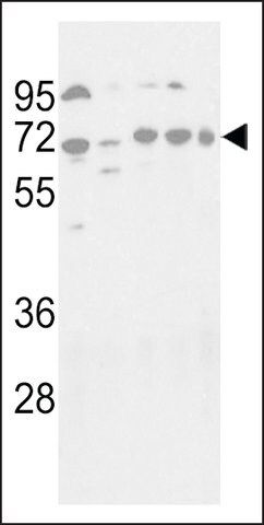 ANTI-ATG16L(C-TERMINAL) antibody produced in rabbit
