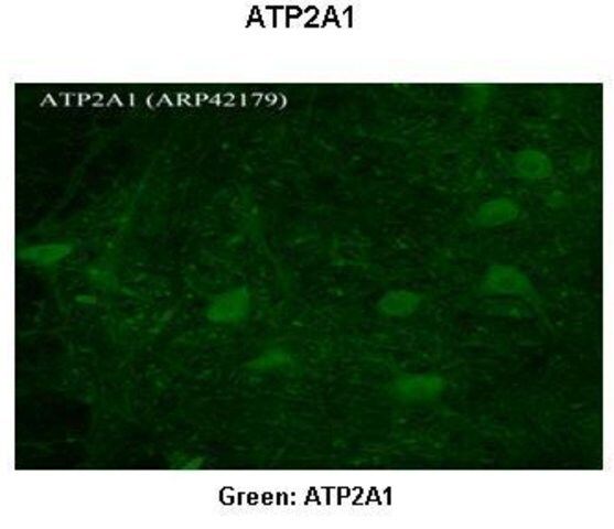 Anti-ATP2A1, (N-terminal) antibody produced in rabbit
