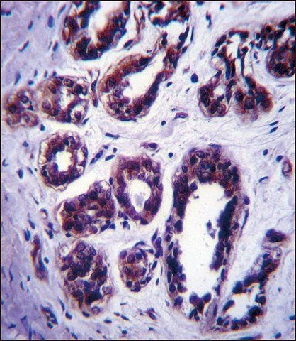 ANTI-ATG9B (C-TERM) antibody produced in rabbit