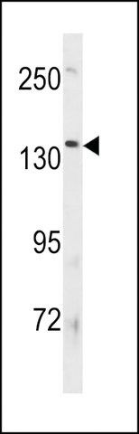 ANTI-ATP8B3(N-TERMINAL) antibody produced in rabbit