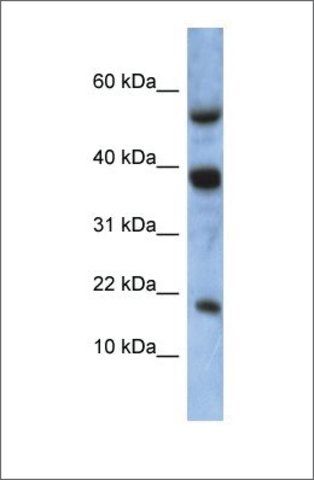 Anti-ATXN7L1 antibody produced in rabbit