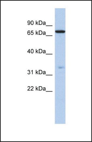 Anti-ATXN7L2, (N-terminal) antibody produced in rabbit