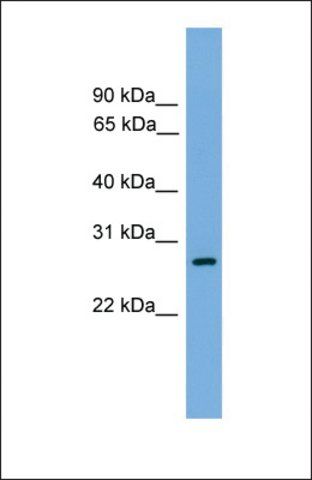 Anti-ATPAF1, (N-terminal) antibody produced in rabbit