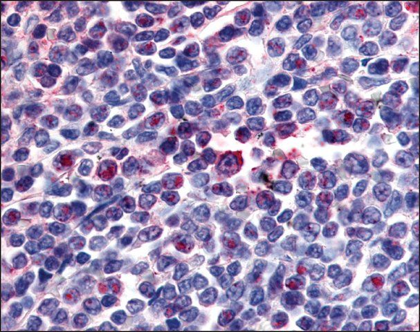 Anti-ATRN / ATTRACTIN antibody produced in rabbit