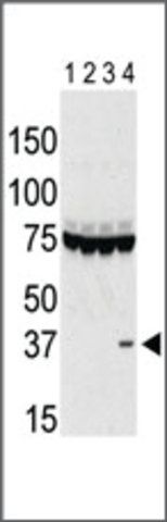 ANTI-AURORA-C (CENTER) antibody produced in rabbit