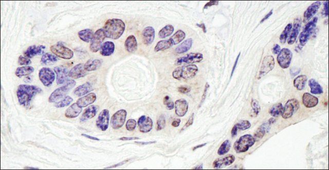 Rabbit anti-TDP1 Antibody, Affinity Purified