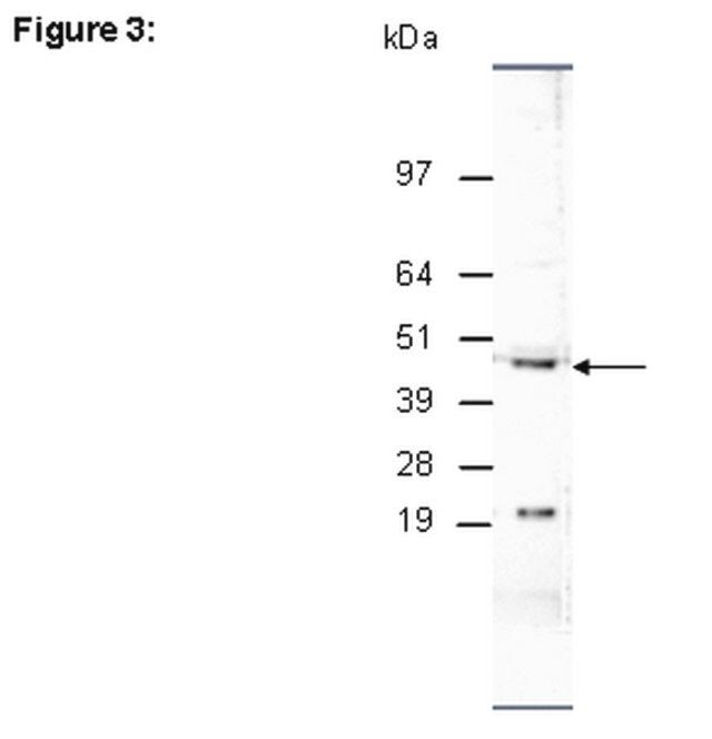 ChIPAb+ JMJD1C-ChIP Validated Antibody and Primer Set