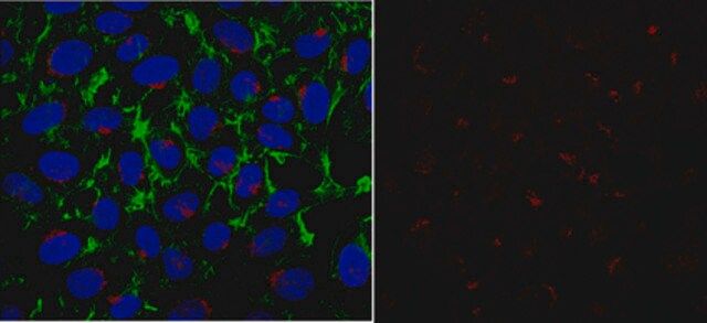 Anti-PFKFB3 Antibody, clone 4C10.2