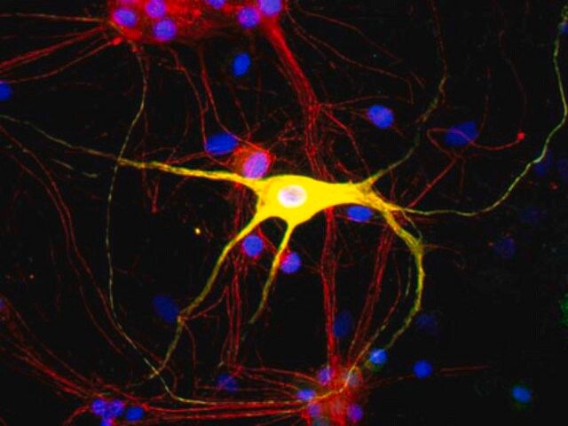 Anti-Peripherin Antibody