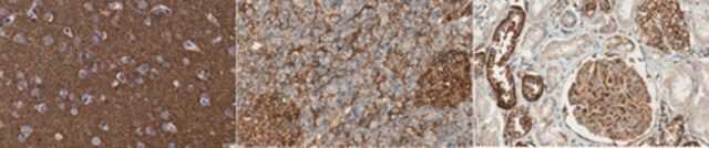 Anti-pan-PMCA Antibody, clone 5F10