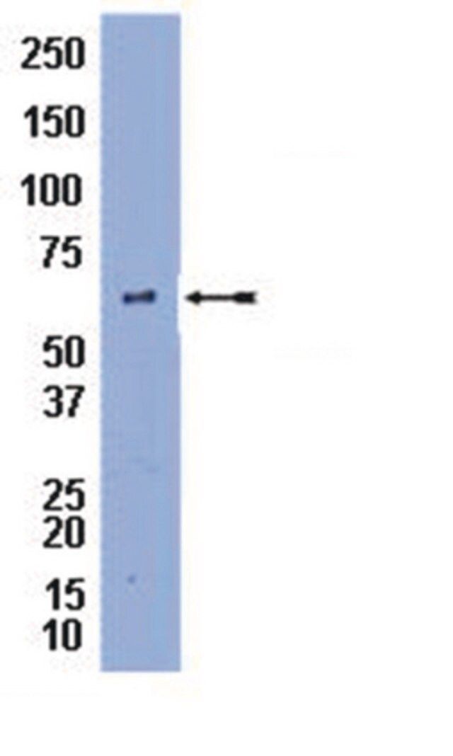 Anti-Perilipin A Antibody