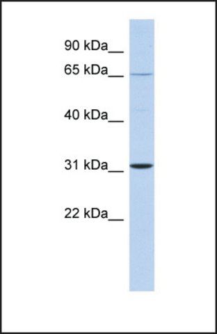 Anti-ZNF691 antibody produced in rabbit