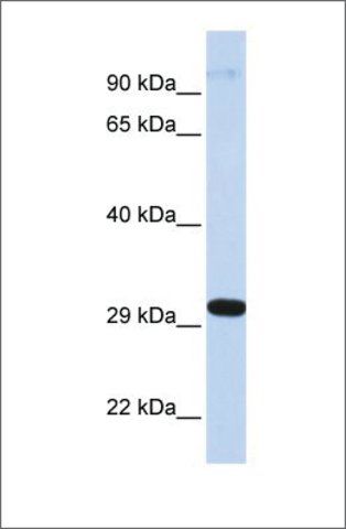 Anti-ZNF688 (ab2) antibody produced in rabbit