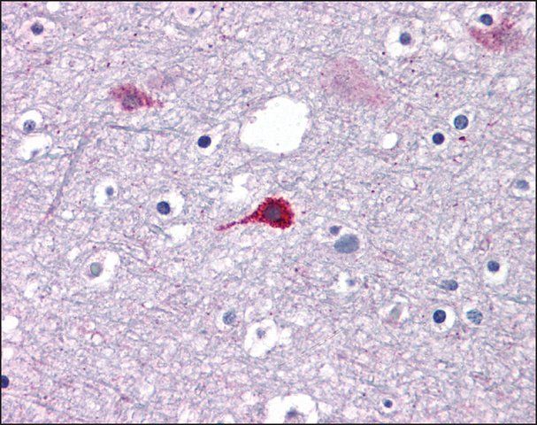 Anti-ZNF687 antibody produced in rabbit