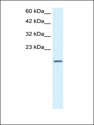 Anti-ZNF7 antibody produced in rabbit
