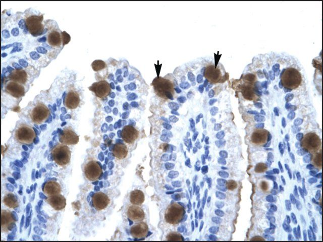 Anti-ZNF70 (AB1) antibody produced in rabbit