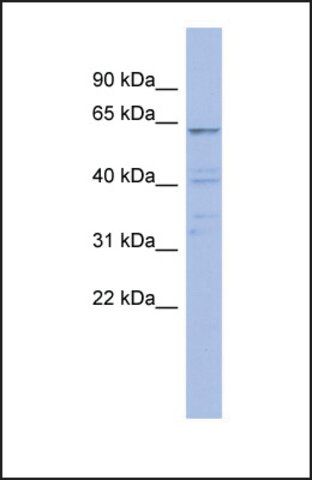 Anti-ZNF689, (N-terminal) antibody produced in rabbit