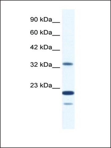 Anti-ZNF688 antibody produced in rabbit