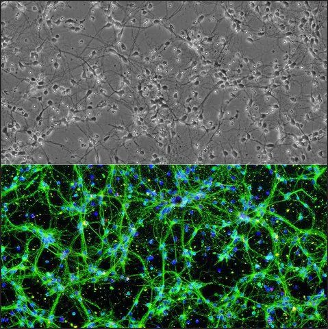 Rat Spinal Cord Neurons: RSpN