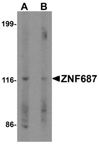 Anti-ZNF687 antibody produced in rabbit