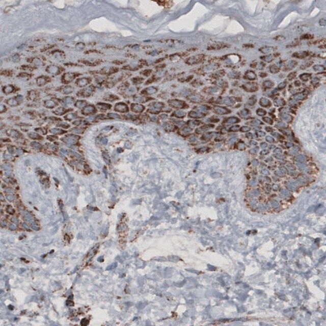 Monoclonal Anti-CS antibody produced in mouse