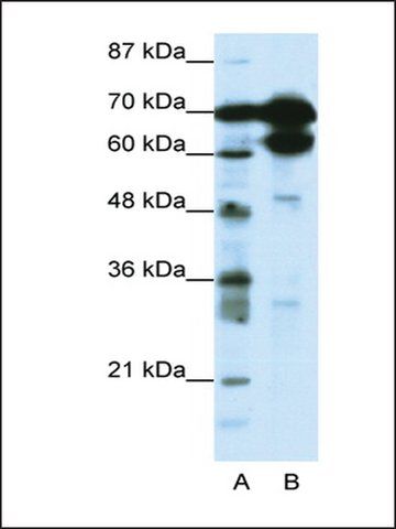 Anti-ZNF76 antibody produced in rabbit