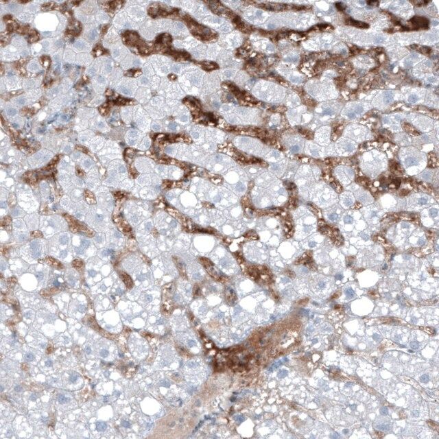Monoclonal Anti-AFP antibody produced in mouse