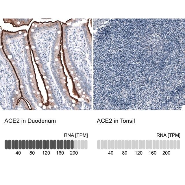 Monoclonal Anti-ACE2 antibody produced in mouse