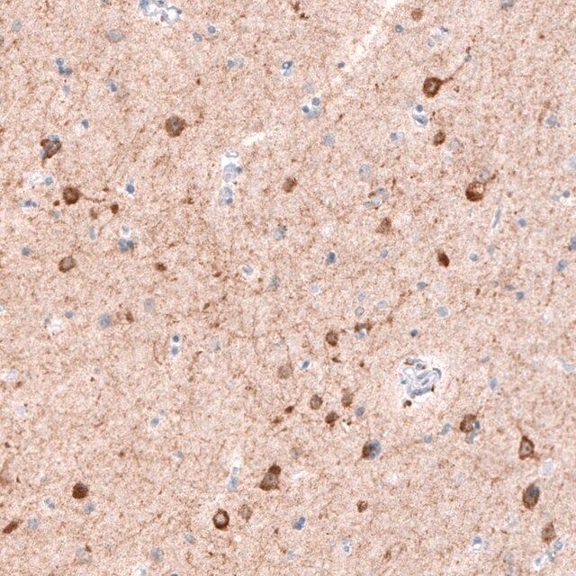 Monoclonal Anti-CDKL5 antibody produced in mouse