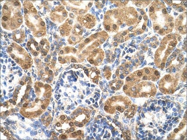 Anti-ENO3 (AB1) antibody produced in rabbit