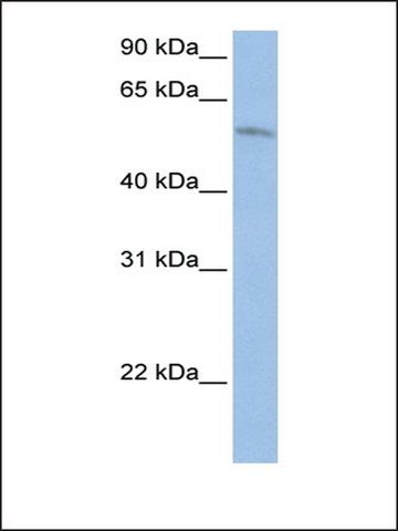 Anti-FAM20C (AB1) antibody produced in rabbit