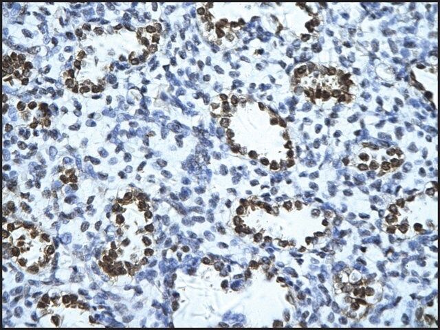 Anti-ENO1 (AB1) antibody produced in rabbit