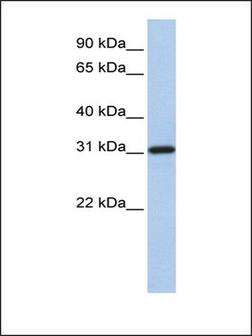 Anti-FBXO16 (AB1) antibody produced in rabbit