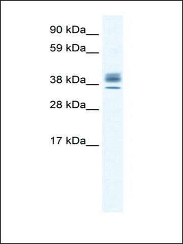 Anti-ESX1 (AB2) antibody produced in rabbit