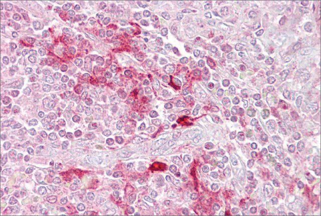 Anti-ETV5 (AB1) antibody produced in rabbit