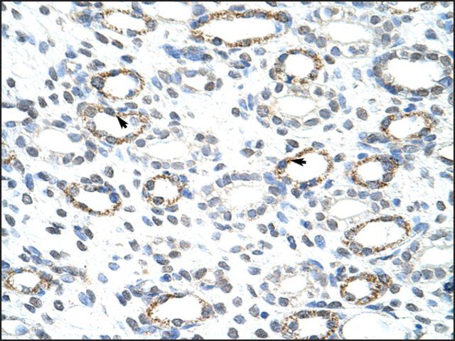 Anti-FOXQ1 (AB2) antibody produced in rabbit
