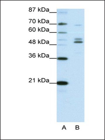 Anti-FOXA2 (AB2) antibody produced in rabbit