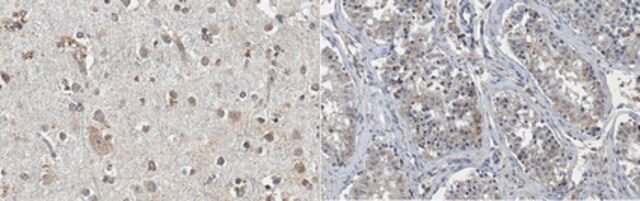 Anti-FMR1polyG Antibody, clone 8FM-2F7